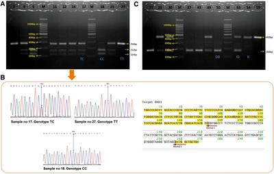 Association polymorphism of guanine nucleotide–binding protein β3 subunit (GNB3) C825T and insertion/deletion of the angiotensin-converting enzyme (ACE) gene with peripartum cardiomyopathy